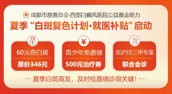 成都白癜风医院哪个好